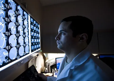 Démence sénile et Alzheimer, comprendre les différences