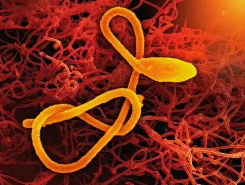 Épidémie d’Ebola Bundibugyo : premiers résultats pour un vaccin